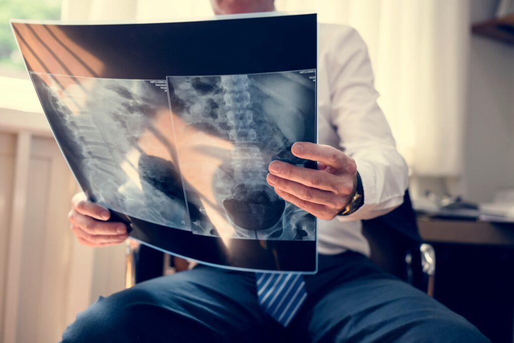 Medical professional reviewing a spinal X-ray image showing vertebrae and spinal alignment.